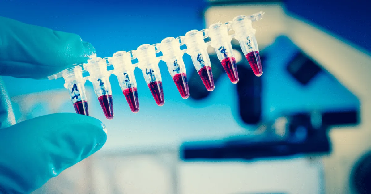 Blue-gloved hand holds up a PCR strip half filled with pink liquid, taking up most of the frame.
